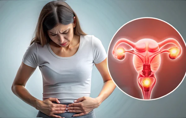 PCOS