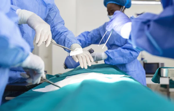 Laparoscopy