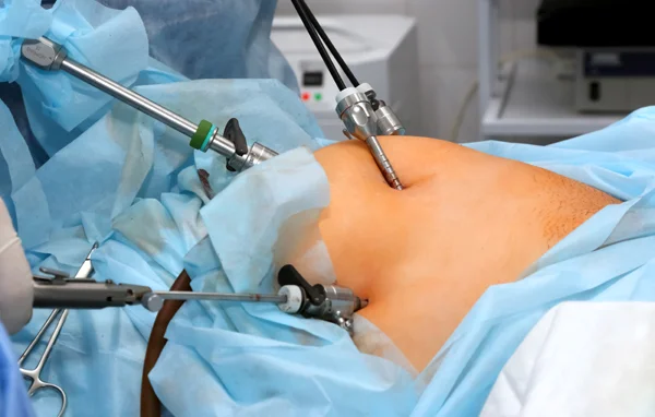 Hysteroscopic Surgery